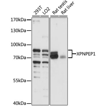 XPNPEP1 Rabbit Polyclonal Antibody