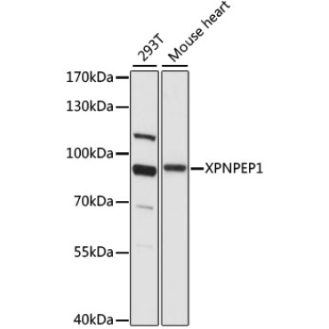 XPNPEP1 Rabbit Polyclonal Antibody