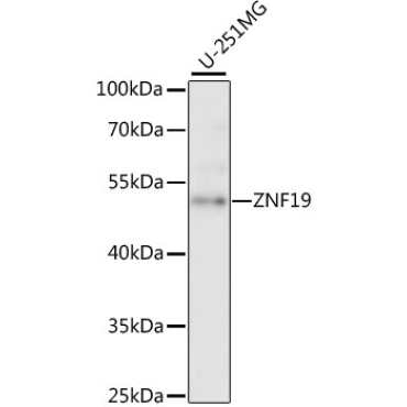 ZNF19 Rabbit Polyclonal Antibody