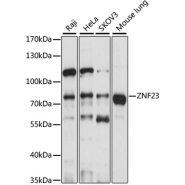 ZNF23 Rabbit Polyclonal Antibody