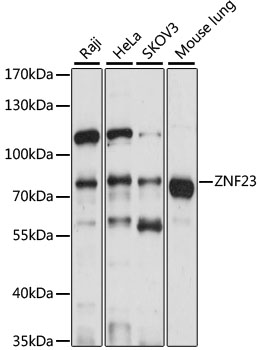 ZNF23 Rabbit Polyclonal Antibody