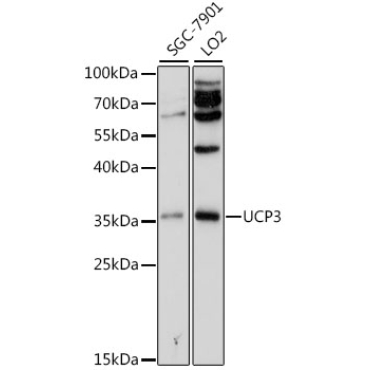 UCP3 Rabbit Polyclonal Antibody