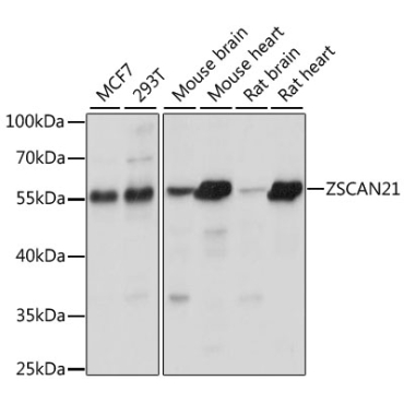 ZSCAN21 Rabbit Polyclonal Antibody