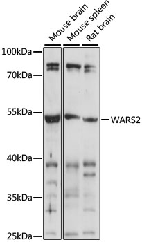WARS2 Rabbit Polyclonal Antibody