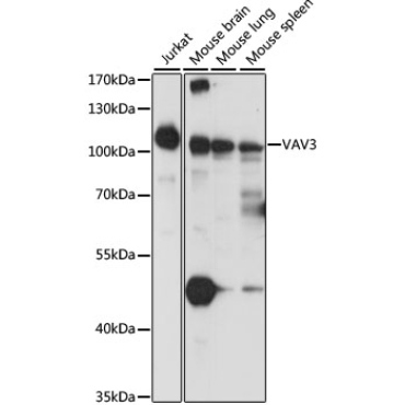VAV3 Rabbit Polyclonal Antibody