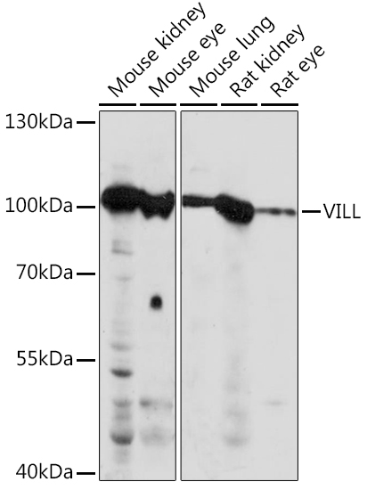 VILL Rabbit Polyclonal Antibody