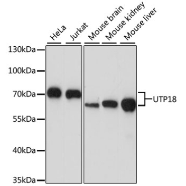 UTP18 Rabbit Polyclonal Antibody