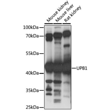 UPB1 Rabbit Polyclonal Antibody