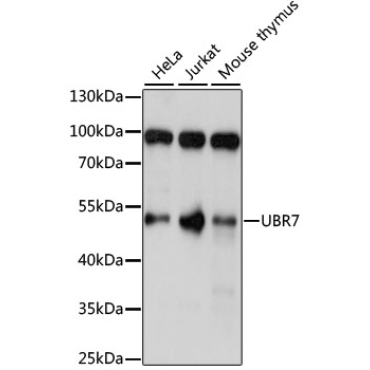 UBR7 Rabbit Polyclonal Antibody