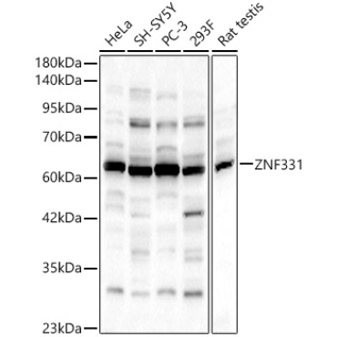 ZNF331 Rabbit Polyclonal Antibody