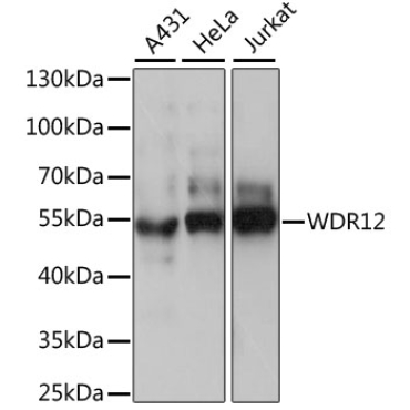 WDR12 Rabbit Polyclonal Antibody