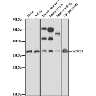 WDR61 Rabbit Polyclonal Antibody