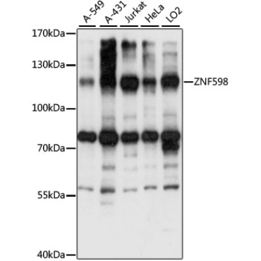 ZNF598 Rabbit Polyclonal Antibody