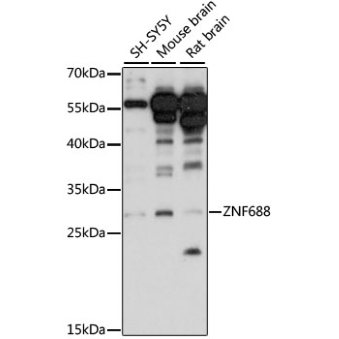 ZNF688 Rabbit Polyclonal Antibody