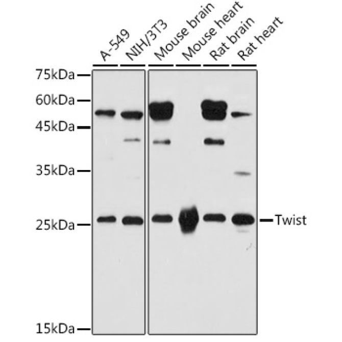 Twist Rabbit Polyclonal Antibody