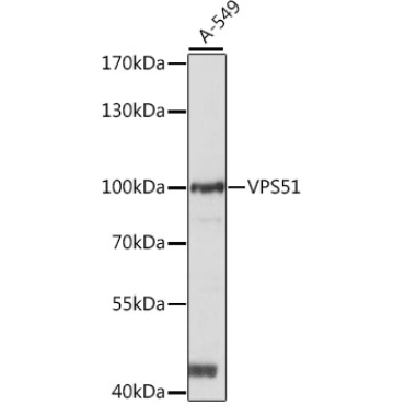VPS51 Rabbit Polyclonal Antibody