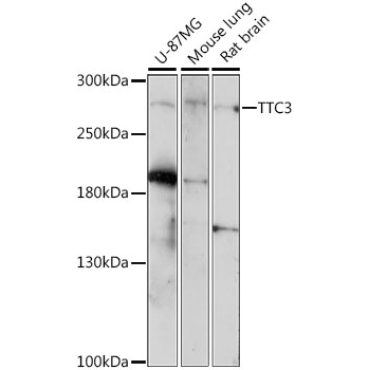 TTC3 Rabbit Polyclonal Antibody