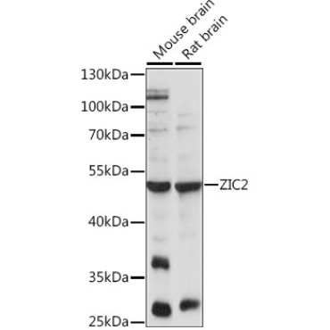 ZIC2 Rabbit Polyclonal Antibody