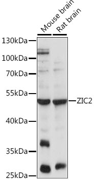 ZIC2 Rabbit Polyclonal Antibody