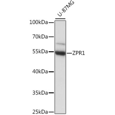 ZPR1 Rabbit Polyclonal Antibody