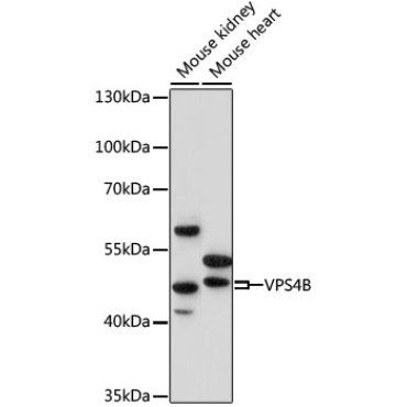 VPS4B Rabbit Polyclonal Antibody
