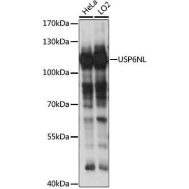 USP6NL Rabbit Polyclonal Antibody