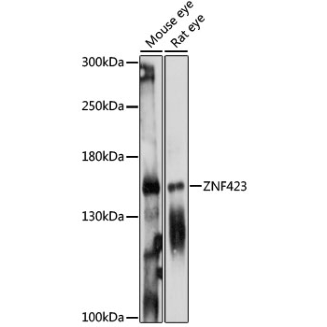 ZNF423 Rabbit Polyclonal Antibody