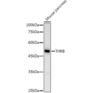 TRBeta1/THRB Rabbit Polyclonal Antibody