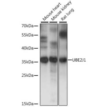 UBE2J1 Rabbit Polyclonal Antibody