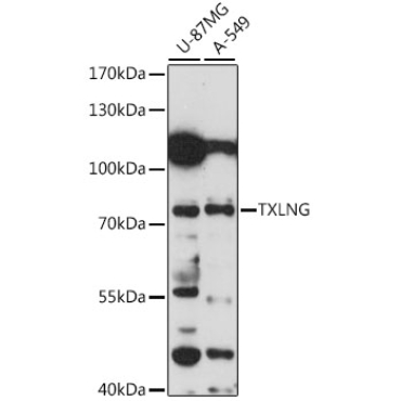 TXLNG Rabbit Polyclonal Antibody