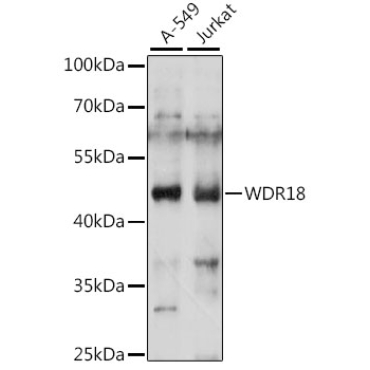 WDR18 Rabbit Polyclonal Antibody