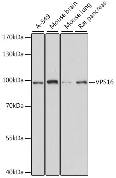 VPS16 Rabbit Polyclonal Antibody