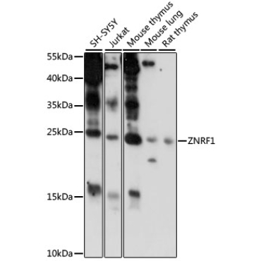 ZNRF1 Rabbit Polyclonal Antibody