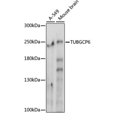 TUBGCP6 Rabbit Polyclonal Antibody