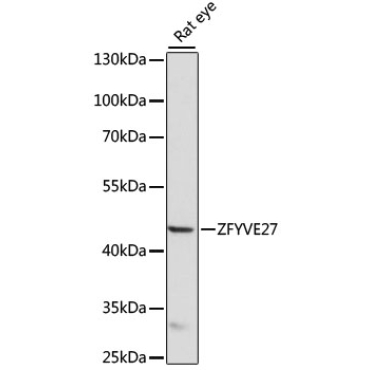 ZFYVE27 Rabbit Polyclonal Antibody