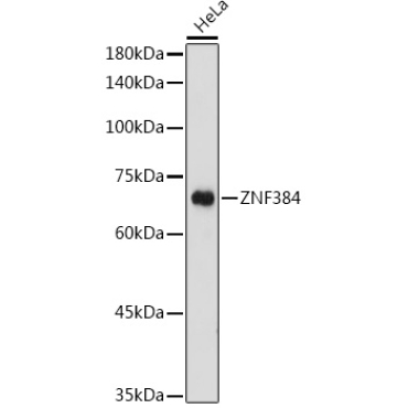 ZNF384 Rabbit Polyclonal Antibody