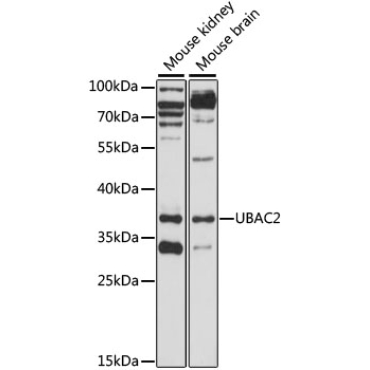 UBAC2 Rabbit Polyclonal Antibody