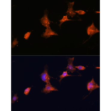 TSC2 Rabbit Polyclonal Antibody