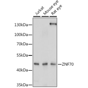 ZNF70 Rabbit Polyclonal Antibody
