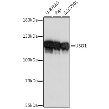 USO1 Rabbit Polyclonal Antibody