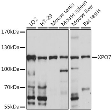 XPO7 Rabbit Polyclonal Antibody