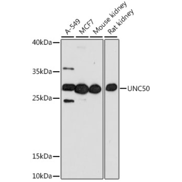 UNC50 Rabbit Polyclonal Antibody