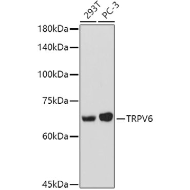 TRPV6 Rabbit Polyclonal Antibody