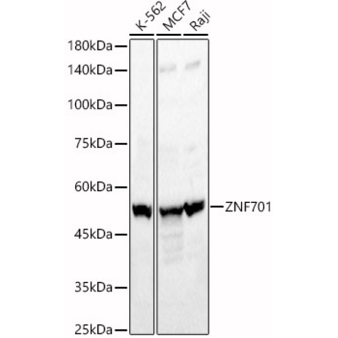 ZNF701 Rabbit Polyclonal Antibody