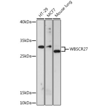 WBSCR27 Rabbit Polyclonal Antibody