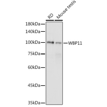 WBP11 Rabbit Polyclonal Antibody