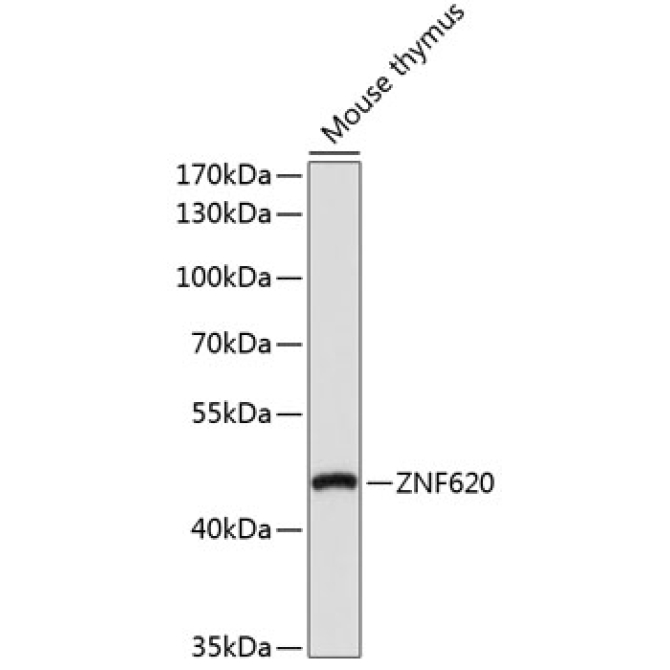 ZNF620 Rabbit Polyclonal Antibody