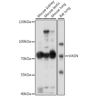 VASN Rabbit Polyclonal Antibody