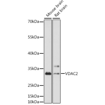 VDAC2 Rabbit Polyclonal Antibody