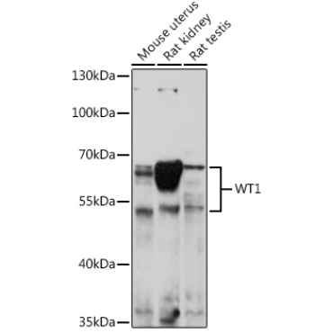 WT1 Rabbit Polyclonal Antibody